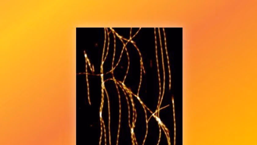 PhD Defence Jonathan Vaneyck | Transmission of the amyloid fold between alpha-Synuclein and other protein species