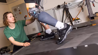 Biomedical Engineering student conducts measurements on a patient with a new prosthesis on a treadmill.