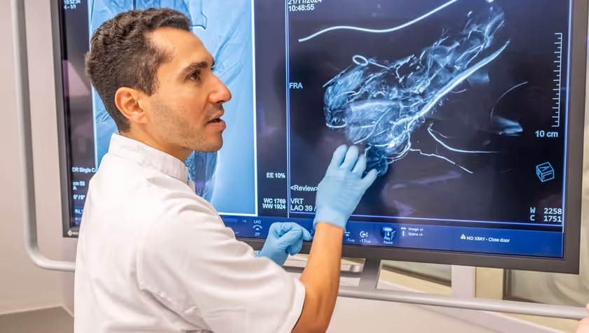 Magnetics microrobots remove blood clots from sheep iliac artery