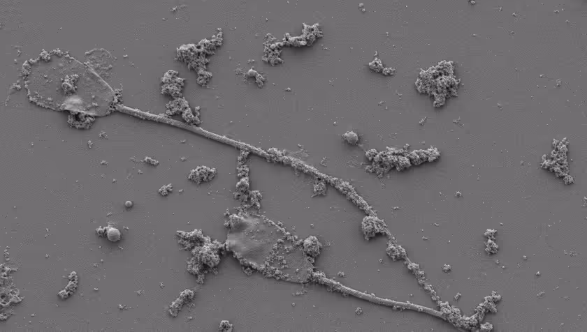 Future of fertility: controlling sperm bots