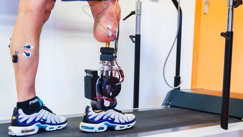 Researchers develop bionic foot that restores a natural walking pattern