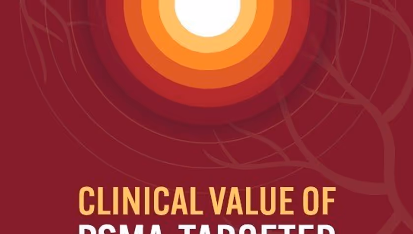 PhD Defence Fleur Kleiburg | Clinical value of PSMA-targeted PET/CT imaging in prostate and non-prostate cancers