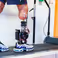 Researchers develop bionic foot that restores a natural walking pattern