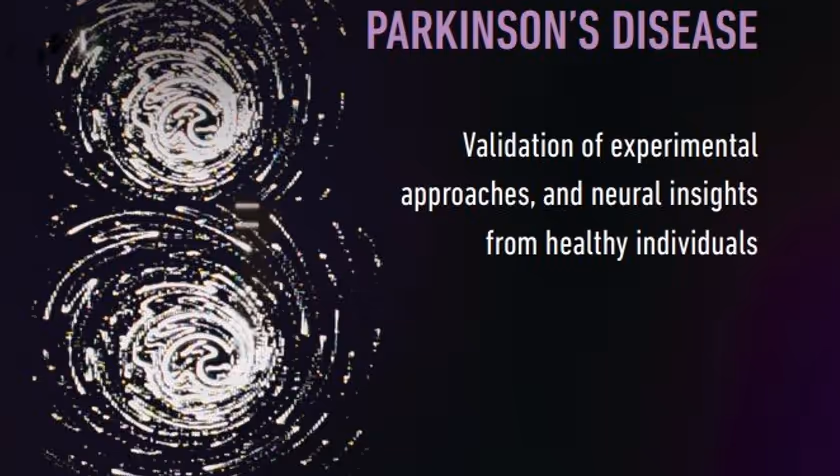 PhD Defence Janne Heijs | Towards a better understanding of cueing for Parkinson’s disease | Validation of experimental approaches, and neural insights from healthy individuals
